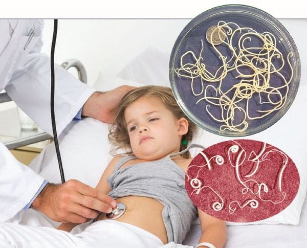 Паразиты в организме у ребенка: признаки, симптомы, лечение