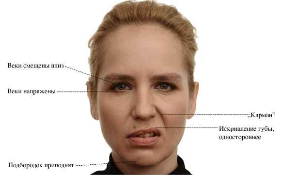Мимические морщины на лице: причины появления и способы коррекции